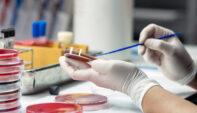 Top 5 Lab Test Result Interpretation Mistakes (and How to Avoid Them)