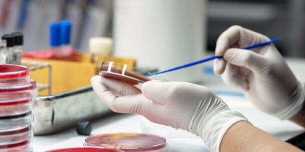 Top 5 Lab Test Result Interpretation Mistakes (and How to Avoid Them)