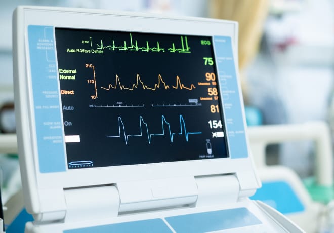 Apple Watch Atrial Fibrillation Feature Is First Digital Health Tech Approved for Clinical Trials 